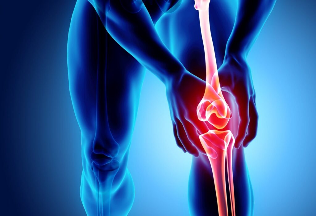 Knee pain illustration